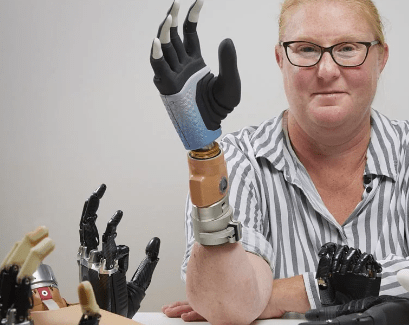 Scientists’ Breakthrough in Prosthetic Limbs: A New Era of Bionic Hands