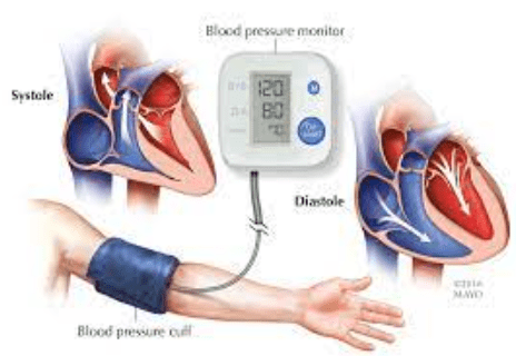 Elevating Hypertension Diagnosis: The Stand-Up Approach to Blood Pressure Measurement